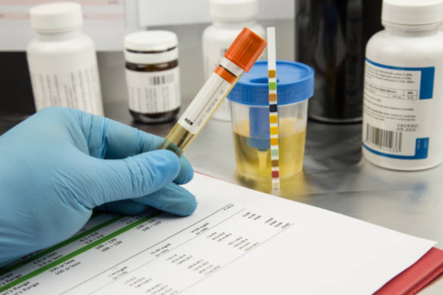 Role of Drug Testing Kits Products In Maintaining healthy Workplace Practices