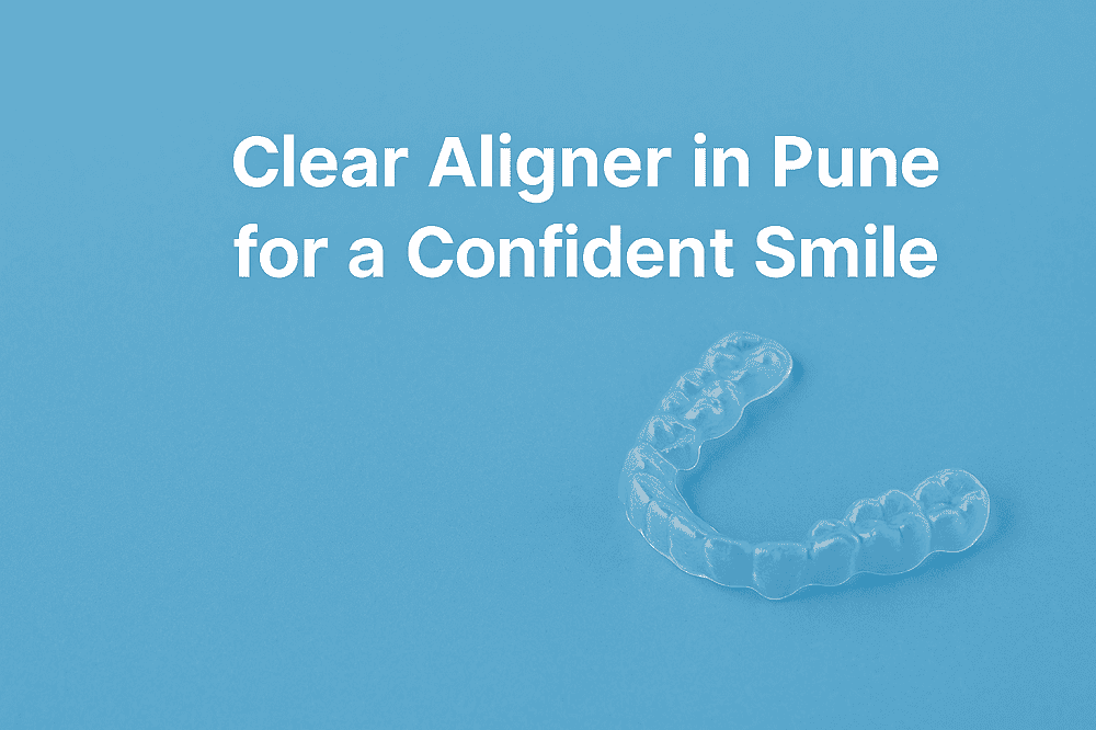 Clear Aligner in Pune